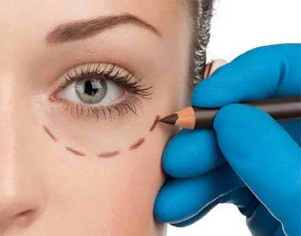 Oculoplasty Workup