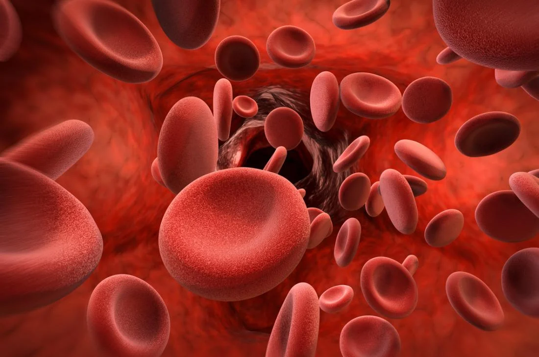 Hemophilia